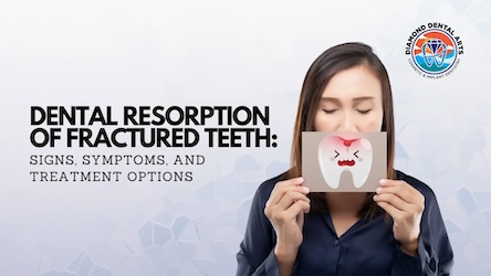 Dental Resorption of Fractured Teeth: Reviewing Causes, Types and Treatment Options