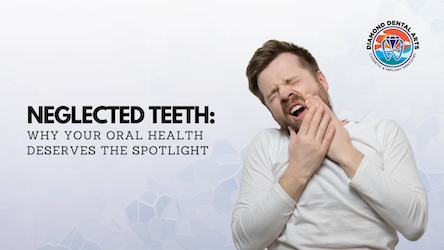 Neglected Teeth: Why Your Oral Health Deserves the Spotlight