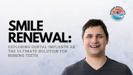 Smile Renewal: Exploring Dental Implants as the Ultimate Solution for Missing Teeth