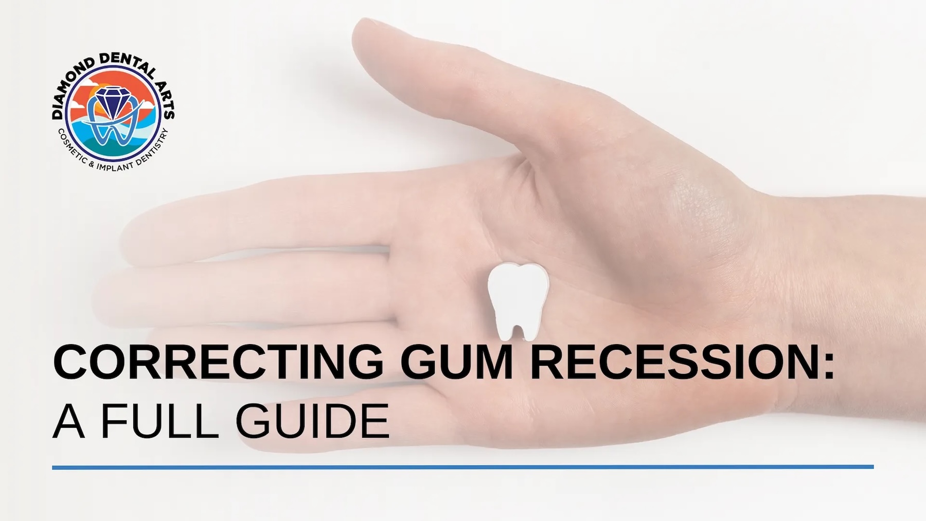 Gum Recession