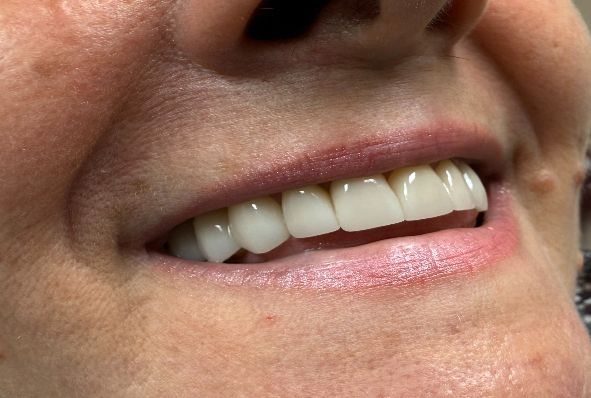 After_case_1_1891x1275