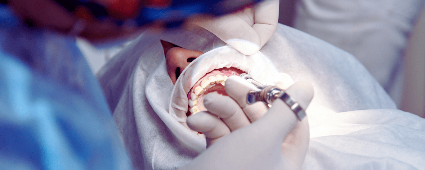 Orl surg - Diamond Dental Arts, Punta Gorda FL