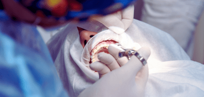 Orl surg - Diamond Dental Arts, Punta Gorda FL