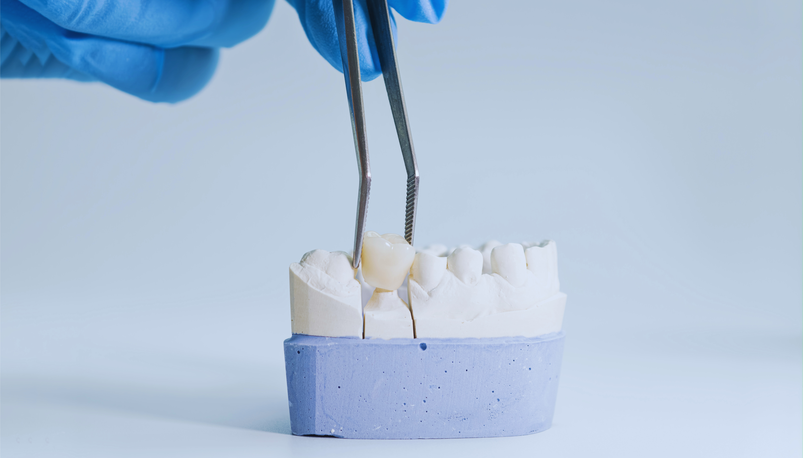 Dental crown protection for a damaged tooth