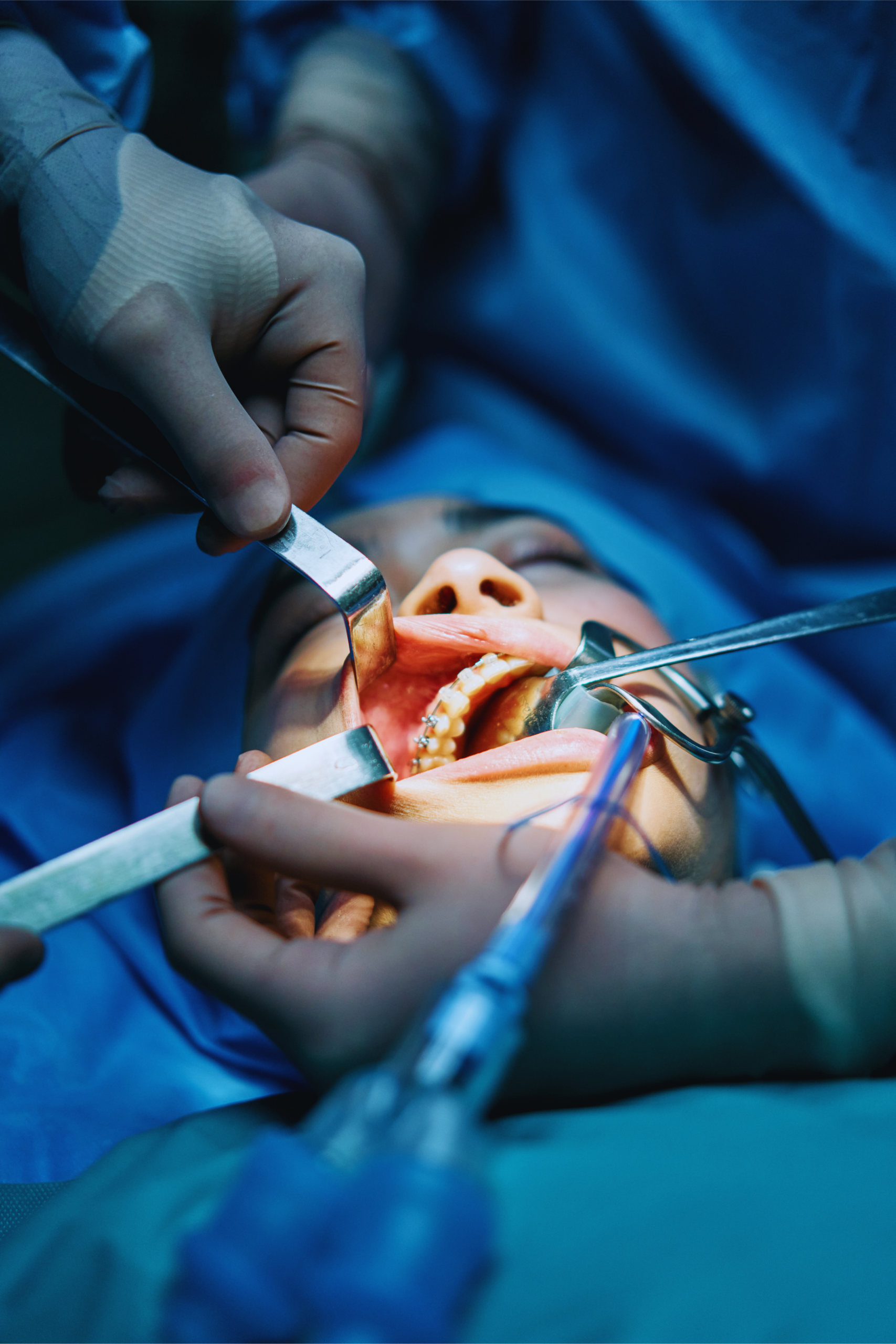 Oral surgery consultation and dental treatment planning