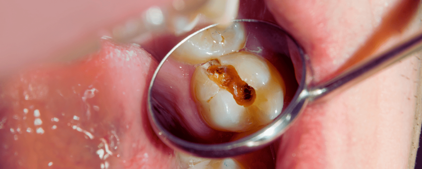 Dental care and services at Diamond Dental Arts in Punta Gorda, FL