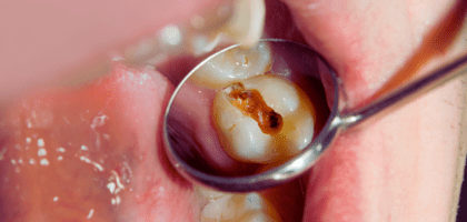 Dental care and services at Diamond Dental Arts in Punta Gorda, FL