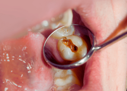 Dental care and services at Diamond Dental Arts in Punta Gorda, FL