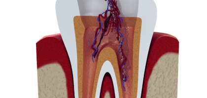 Dental care and services at Diamond Dental Arts in Punta Gorda, FL