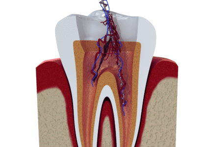 Dental care and services at Diamond Dental Arts in Punta Gorda, FL