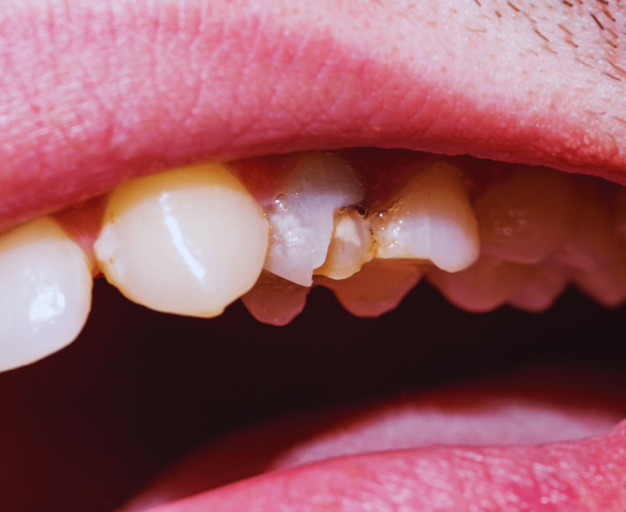 Restorative dentistry options at Diamond Dental Arts