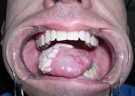 Oral health examination and screening example image
